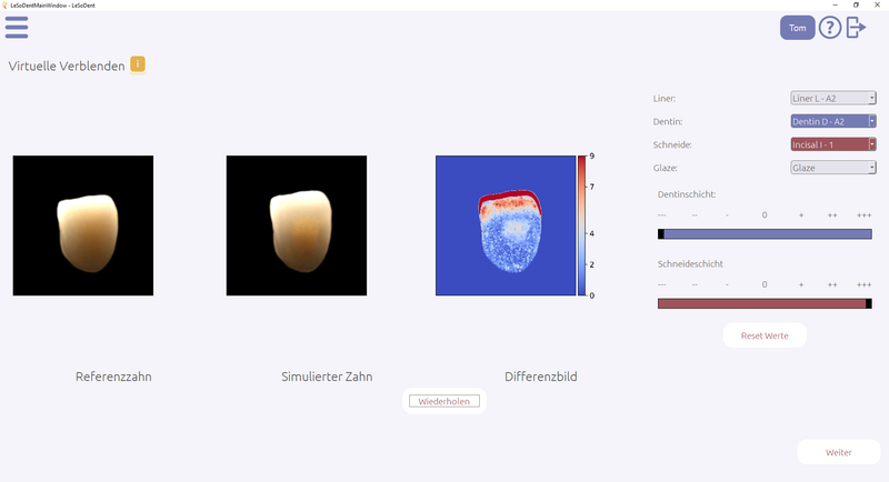 Bildschirmfoto von Zahntechnik-Software